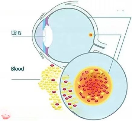 OEM/ODM Private Label Lutein Eye Vision Guard with Zeaxanthin for eye healthcare